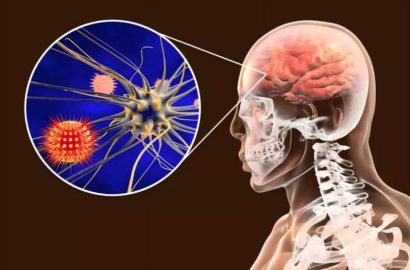 Meningococcal ကာကွယ်ဆေးလမ်းညွှန် Meningococcal ကာကွယ်ဆေးလမ်းညွှန်